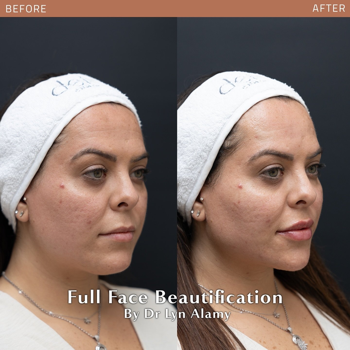 dr.lyn.alamy_1721576749_3417155907636301146_5685527472