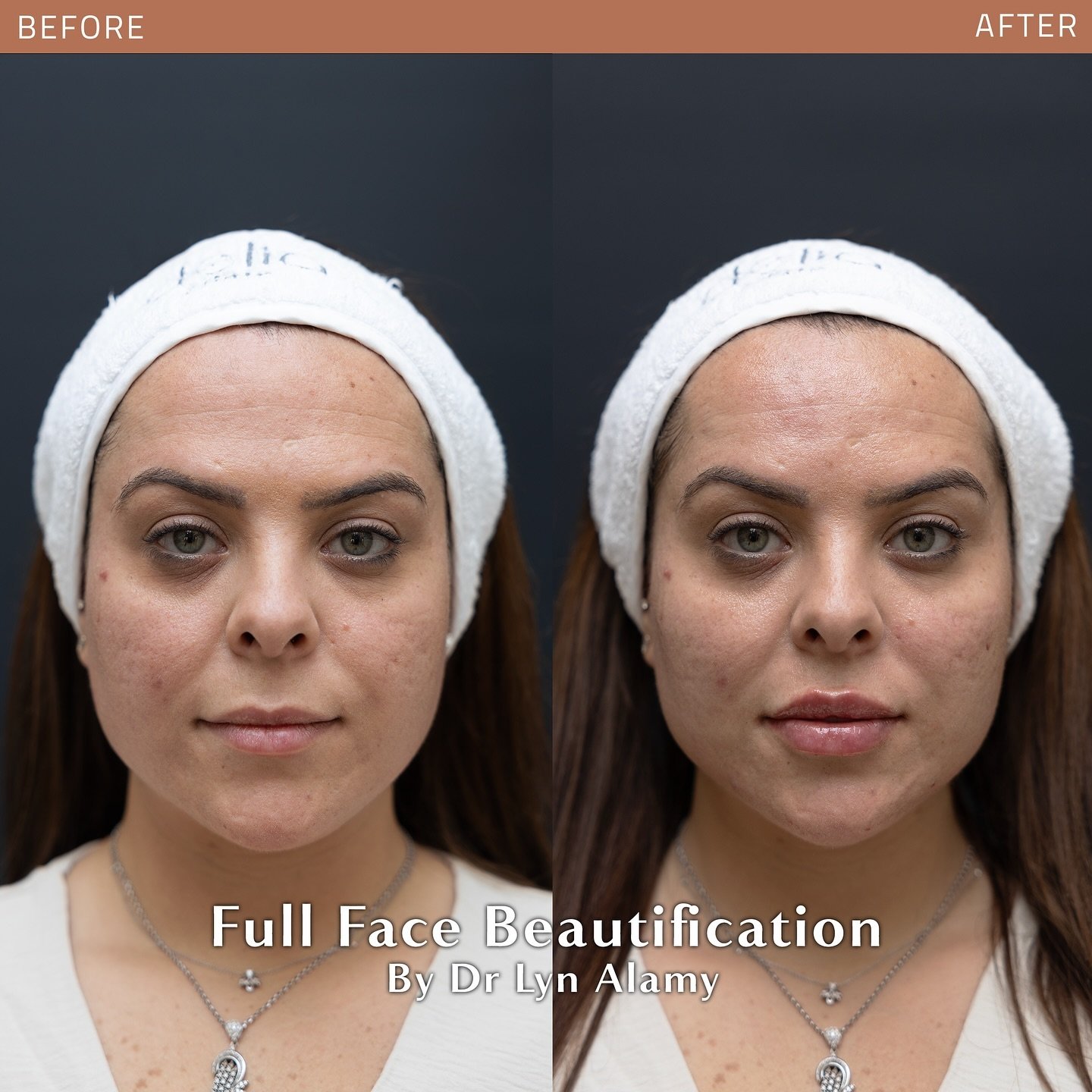 dr.lyn.alamy_1721576749_3417155907644687411_5685527472